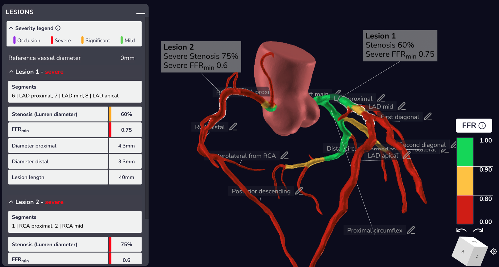 Slipstream Interface